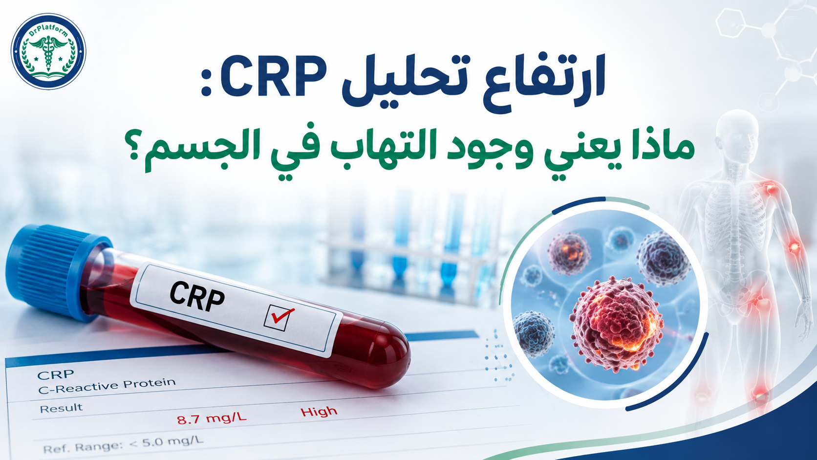 ارتفاع تحليل CRP وأسباب الالتهاب في الجسم